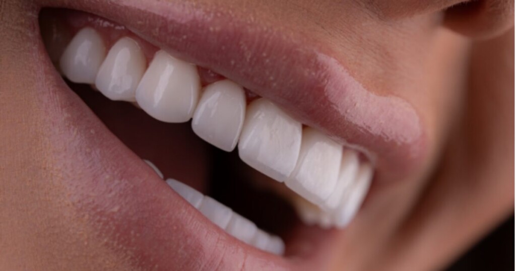 Aesthetic Dentistry