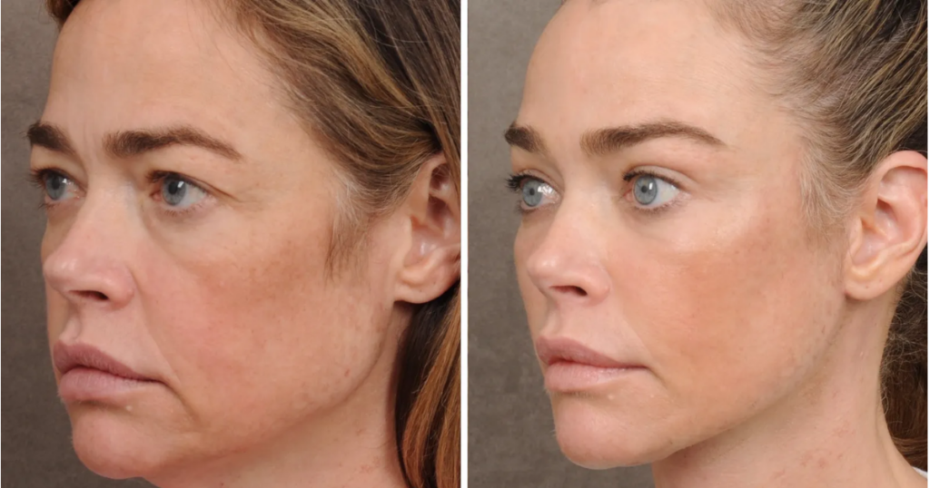 Denise Richards