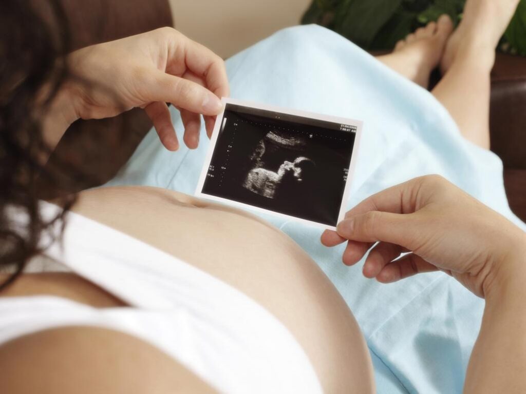 Bebé recién nacido y calendario que muestra los meses con más nacimientos